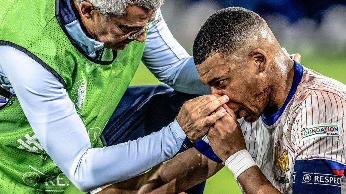 Operasi Hidung Menanti Mbappe di Tengah Persiapan Euro 2024